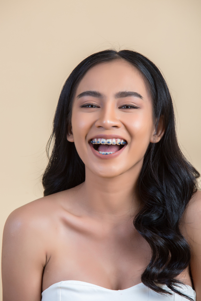 Aesthetic orthodontic treatment