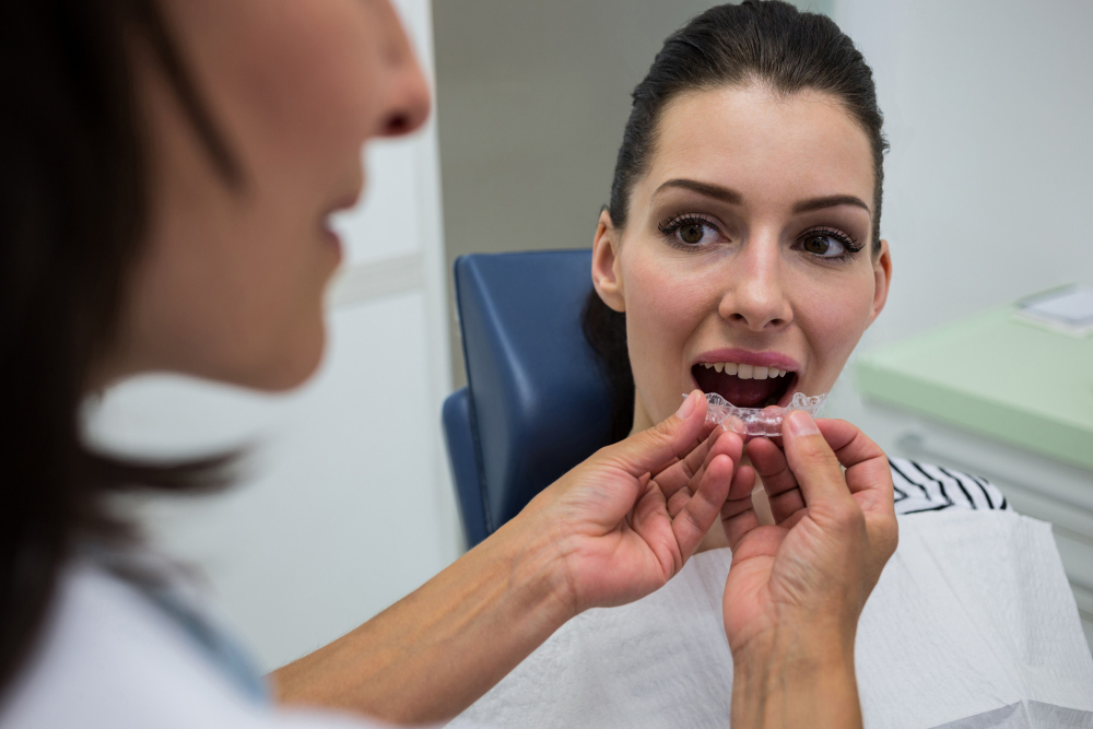 Clear aligners