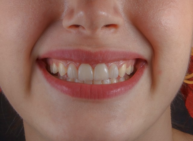 Dental professional providing care